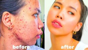 skin care Routine