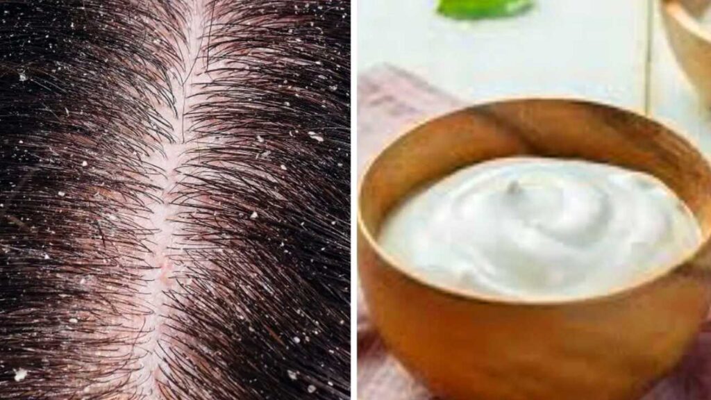 Curd Mask for hair