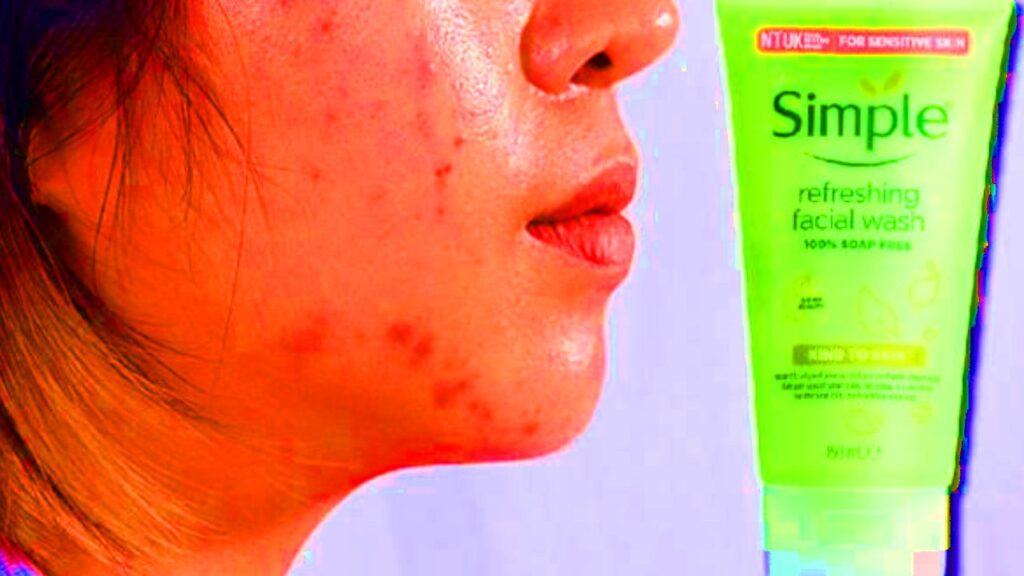 Simple Face Wash for Oily Skin