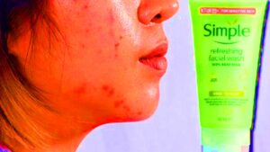 Simple Face Wash for Oily Skin